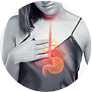 Acid Reflux